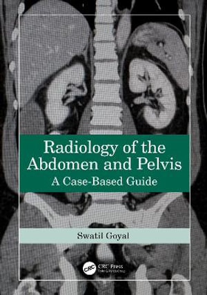 Radiology of the Abdomen and Pelvis : A Case-Based Guide - Swati  Goyal