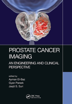 Prostate Cancer Imaging : An Engineering and Clinical Perspective - Ayman El-Baz