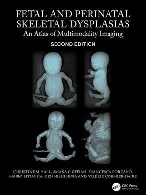 Fetal and Perinatal Skeletal Dysplasias : An Atlas of Multimodality Imaging - Christine M Hall