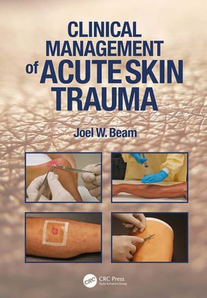 Clinical Management of Acute Skin Trauma - Joel W. Beam