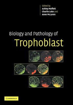 Biology and Pathology of Trophoblast - Ashley Moffett