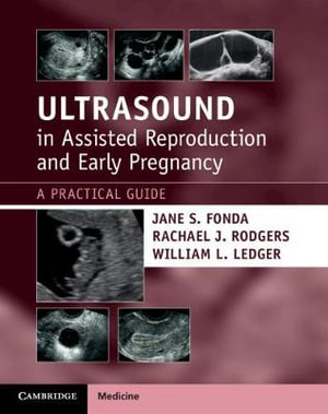 Ultrasound in Assisted Reproduction and Early Pregnancy : A Practical Guide - Jane S. Fonda