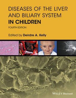 Diseases of the Liver and Biliary System in Children - Deirdre A. Kelly