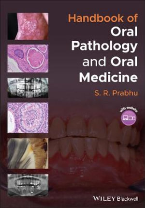 Handbook of Oral Pathology and Oral Medicine - S. R. Prabhu