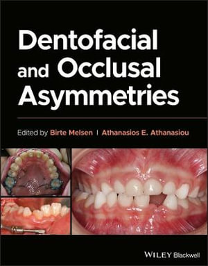 Dentofacial and Occlusal Asymmetries - Birte Melsen