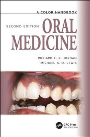 Oral Medicine : Medical Color Handbook Series - Michael Lewis