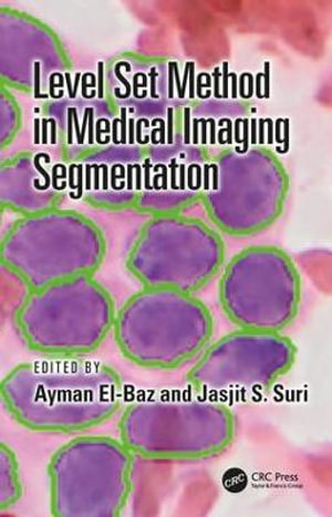 Level Set Method in Medical Imaging Segmentation - Ayman El-Baz