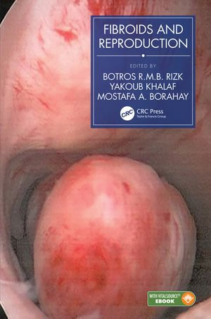 Fibroids and Reproduction - Botros R.M.B. Rizk