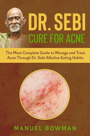 Dr Sebi Cure For Acne The Most Complete Guide To Manage And Treat Acne Through Dr Sebi Alkaline Eating Habits Ebook By Manuel Bowman Booktopia