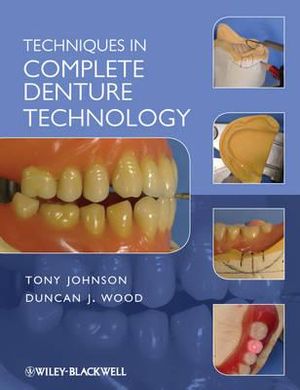 Techniques in Complete Denture Technology - Tony Johnson