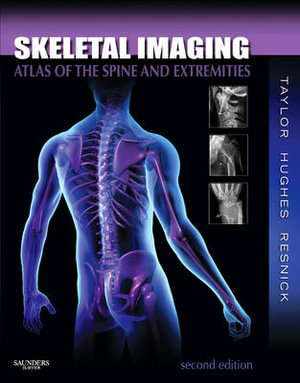 Skeletal Imaging, Second Edition : Atlas of the Spine and Extremities - John Taylor