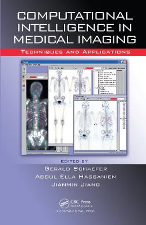 Computational Intelligence in Medical Imaging : Techniques and Applications - A. Hassanien