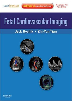 Fetal Cardiovascular Imaging: A Disease Based Approach : Expert Consult Premium - Jack Rychik