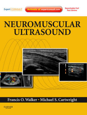 Neuromuscular Ultrasound : Expert Consult - Online and Print - Francis Walker