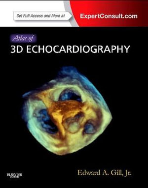 Atlas of 3D Echocardiography : Expert Consult 1e - Edward Gill