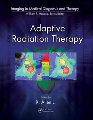 Adaptive Radiation Therapy : Imaging in Medical Diagnosis and Therapy - X. Allen Li