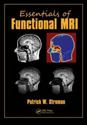 Essentials of Functional MRI : Series in Medical Physics and Biomedical Engineering - Patrick W. Stroman