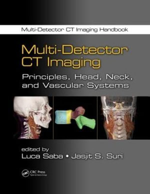 Multi-Detector CT Imaging : Principles, Head, Neck, and Vascular Systems - Luca Saba