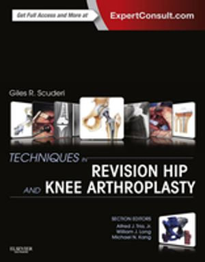 Techniques in Revision Hip and Knee Arthroplasty E-Book : Expert Consult - Giles R Scuderi