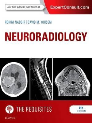 Neuroradiology : The Requisites - Rohini Nadgir