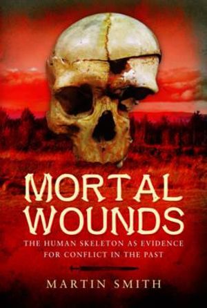 Mortal Wounds : The Human Skeleton A Evidence For Conflict in the Past - Martin Smith