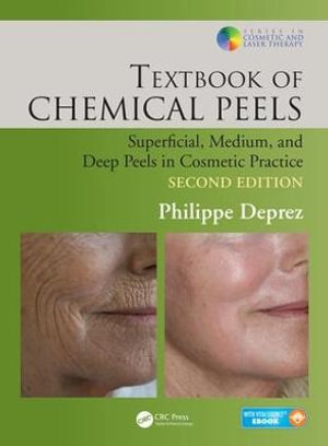 Textbook of Chemical Peels : Superficial, Medium, and Deep Peels in Cosmetic Practice - Philippe Deprez