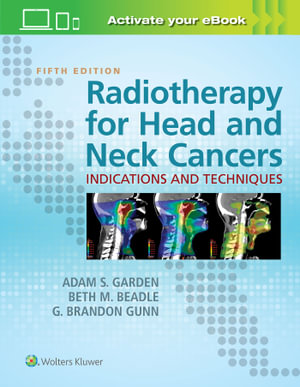 Radiotherapy for Head and Neck Cancers : Indications and         Techniques - Garden