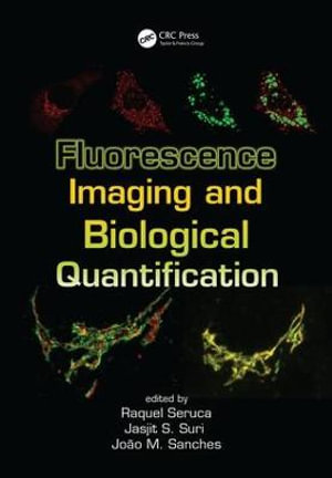 Fluorescence Imaging and Biological Quantification - Raquel Seruca