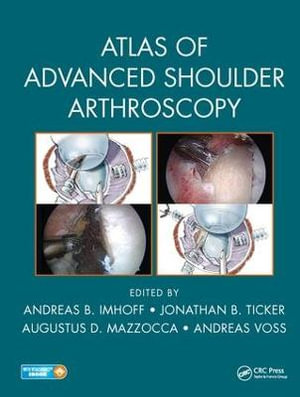 Atlas of Advanced Shoulder Arthroscopy - Andreas B. Imhoff