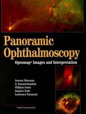 Panoramic Ophthalmoscopy : Optomap Images and Interpretation - Jerry Sherman