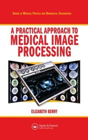 A Practical Approach to Medical Image Processing : Series in Medical Physics and Biomedical Engineering - Elizabeth Berry