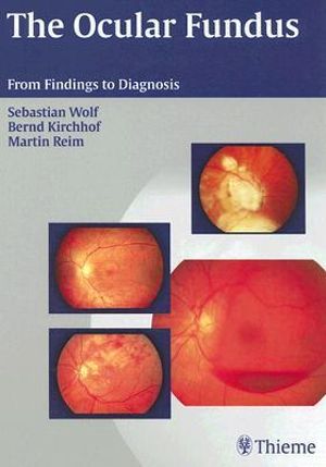 The Ocular Fundus : From Findings to Diagnosis - Sebastian Wolf