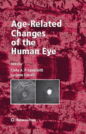 Age-Related Changes of the Human Eye : Aging Medicine - Carlo Cavallotti