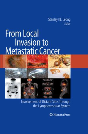 From Local Invasion to Metastatic Cancer : Involvement of Distant Sites Through the Lymphovascular System - Stanley P. L. Leong