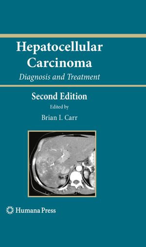 Hepatocellular Carcinoma : Diagnosis and Treatment - Brian I. Carr