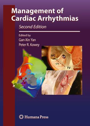 Management of Cardiac Arrhythmias : Contemporary Cardiology - Gan-Xin Yan