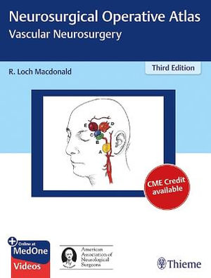 Neurosurgical Operative Atlas : Third Edition : Vascular Neurosurgery - R. Loch Macdonald