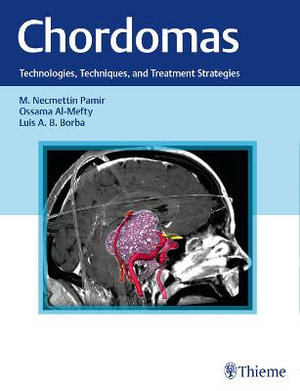 Chordomas : Technologies, Techniques, and Treatment Strategies - M. Necmettin Pamir