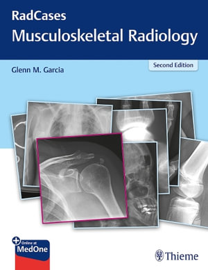 Radcases Musculoskeletal Radiology : 2nd Edition - Glenn M. Garcia