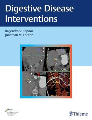 Digestive Disease Interventions - Baljendra S. Kapoor