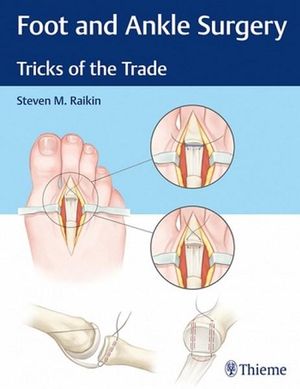 Foot and Ankle Surgery : Tricks of the Trade - Steven M. Raikin