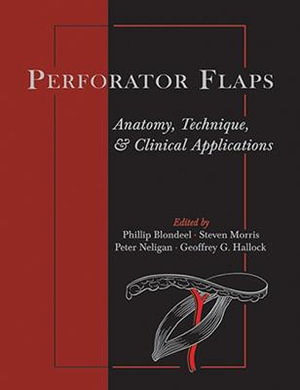 Perforator Flaps : Anatomy, Technique, & Clinical Applications : 2nd Edition - Phillip N. Blondeel