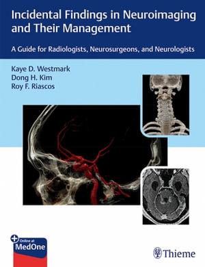Incidental Findings in Neuroimaging and Their Management : A Guide for Radiologists, Neurosurgeons, and Neurologists - Kaye D. Westmark