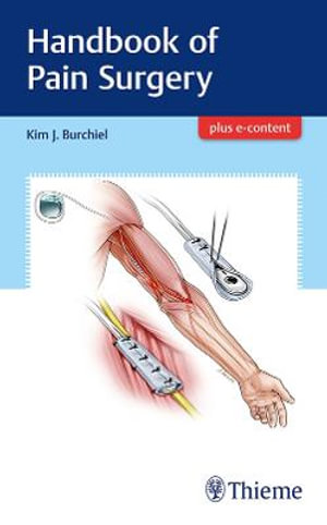 Handbook of Pain Surgery : Plus e-content - Kim Burchiel