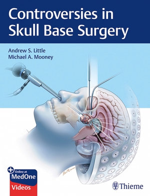 Controversies in Skull Base Surgery - Andrew S. Little