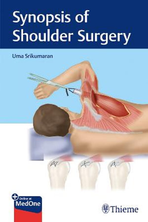 Synopsis of Shoulder Surgery - Uma Srikumaran