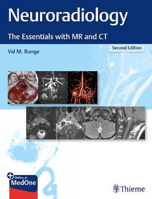 Neuroradiology : 2nd Edition - The Essentials with MR and CT - Val M. Runge