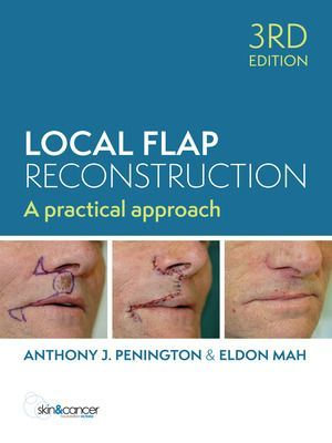 Schematic of the DIEP flap reconstructive surgery and