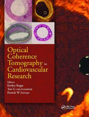 Optical Coherence Tomography in Cardiovascular Research - Evelyn Regar