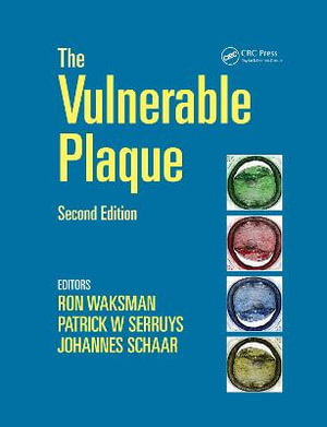 Handbook of the Vulnerable Plaque - Ron Waksman